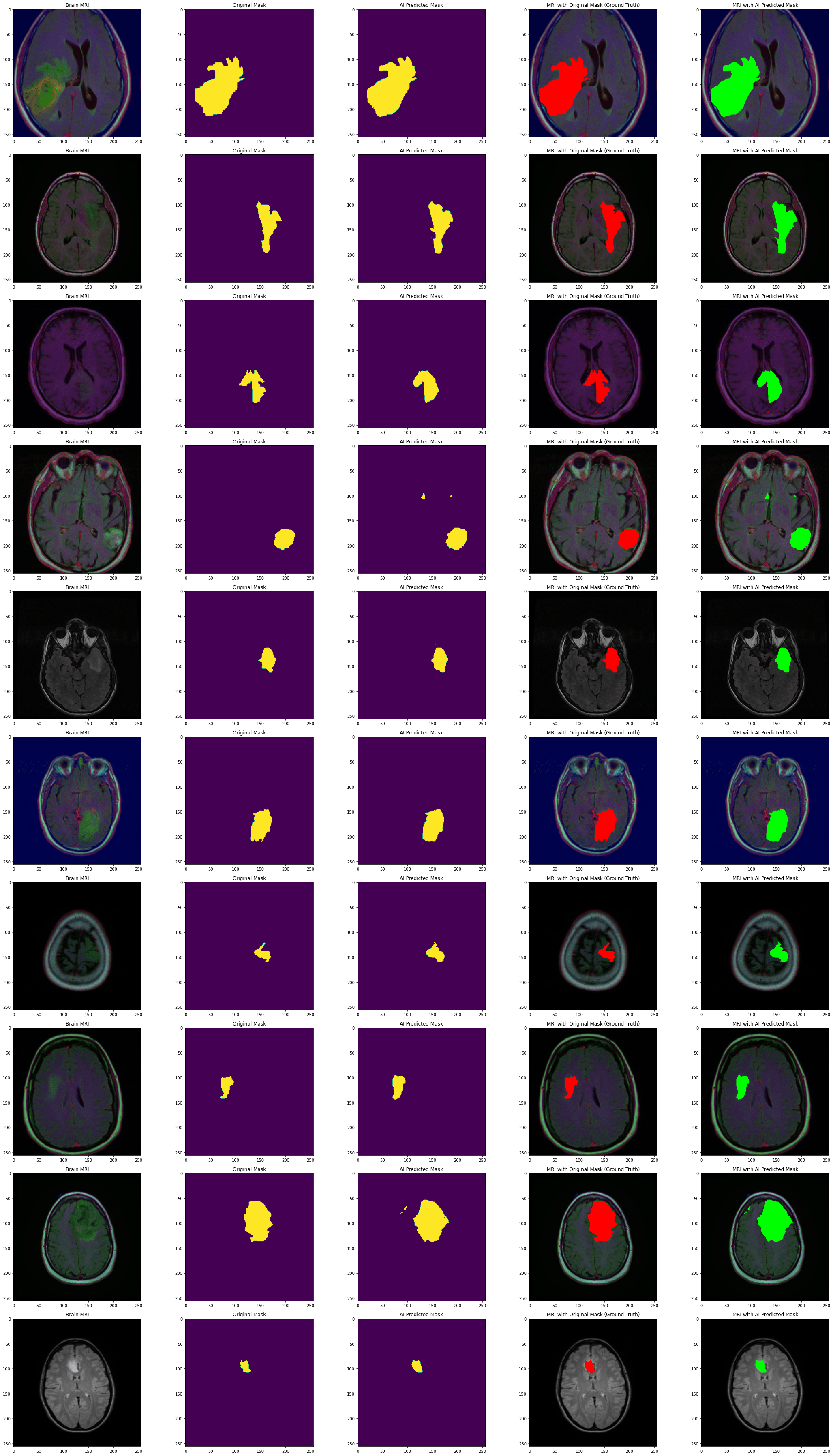 GitHub LaloGarces/BrainTumorsDetectionDeepLearning Applying AI